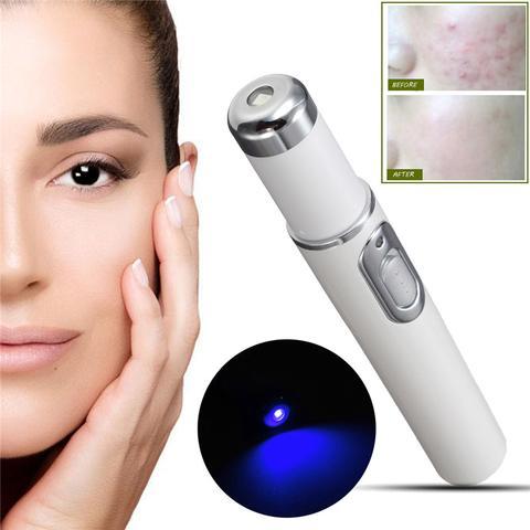Acne Laser Blue Light Therapy P